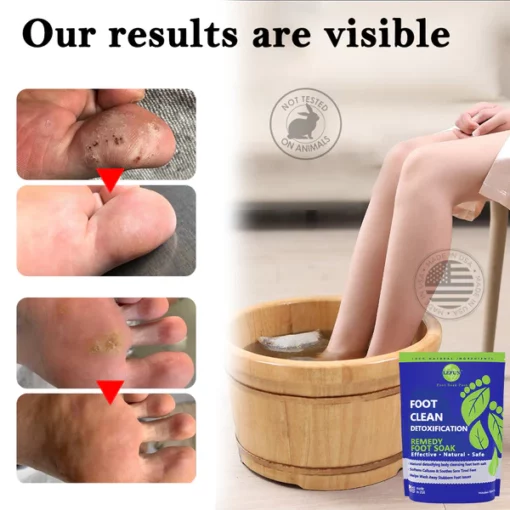 LEFUN™ Herbal Detoxifying Cleansing Foot Care Pack - Image 2