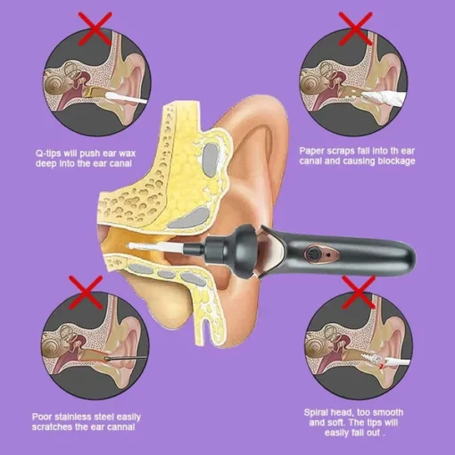 LuminSmile™Painless ear cleaning for the whole family - Image 6