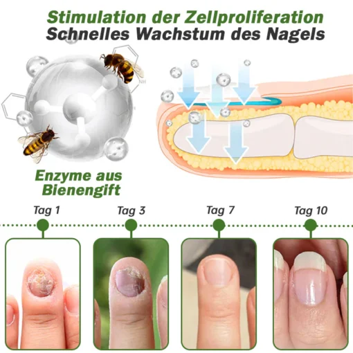 Furzero™ Nagelverteidigung Bienengift-Behandlungsserum - Image 5