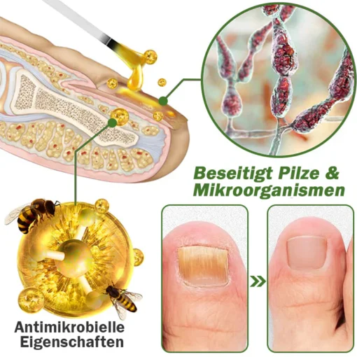 Furzero™ Nagelverteidigung Bienengift-Behandlungsserum - Image 8