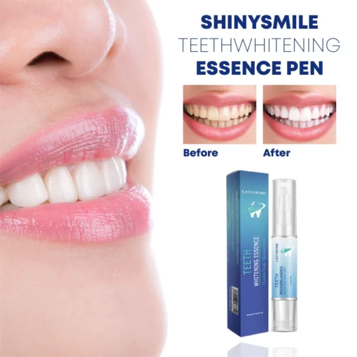 Furzero™Teeth Whitening Essence Pen