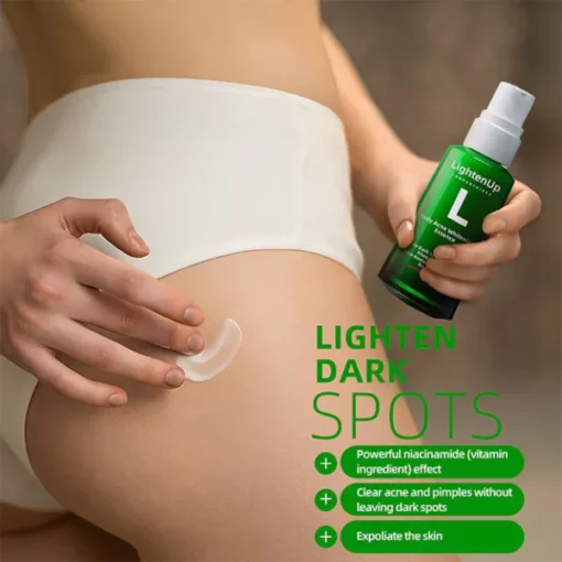 LightenUp™ Buttocks Acne Erasing Serum(for Acne & Spots & Acanthosis Nigricans Removal) - Image 7