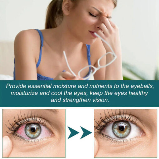 Seurico™ Eye Drops Relieve Eye Discomfort Repair Eye Fatigue Dryness Blurred Vision - Image 4