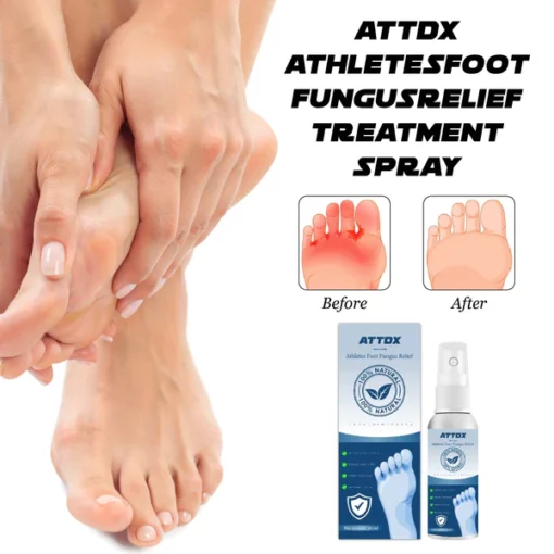 ATTDX AthletesFoot FungusRelief TreatmentSpray - Image 2