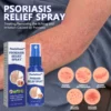 PsoriaGone™ Psoriasis relief spray