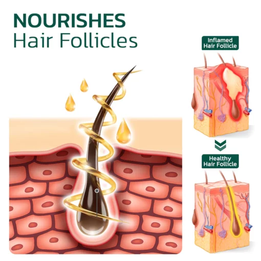 HairVive™ Scalp Folliculitis Therapy Oil - Image 4