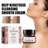 ruelens™ KeratosisTreat Deep Clean Smooth Cream