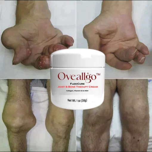 Oveallgo™ FlexiCure PRO Gelenk- und Knochentherapie-Creme - Image 9