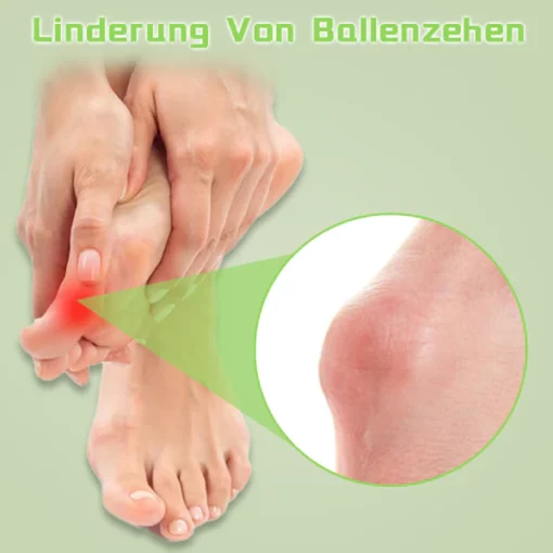 Biancat™ Hallux Valgus Entlastungspflaster - Image 4