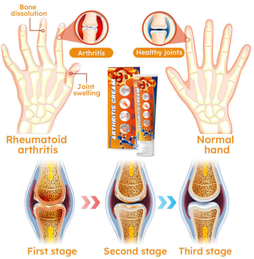 Lotmay™ Turmeric Arthritis Cream - Image 7