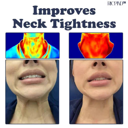 RICPIND IONIC Therapy NeckPain ReliefPad - Image 9