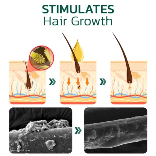 HairVive™ Scalp Folliculitis Therapy Oil - Image 3