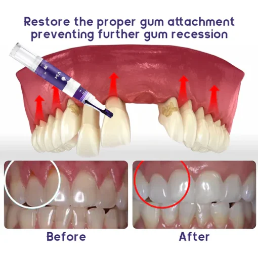 Seurico™ Gum Therapy Gel - Upgraded formula for superior cleansing and repair - Image 7