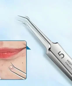 Professional Facial Blackhead Remover Tweezers