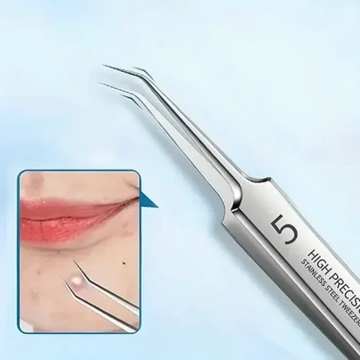 Professional Facial Blackhead Remover Tweezers