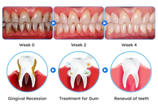 Seurico™ Gum Therapy Gel - Upgraded formula for superior cleansing and repair - Image 5