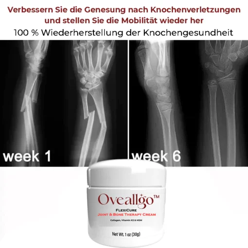 Oveallgo™ FlexiCure PRO Gelenk- und Knochentherapie-Creme - Image 5