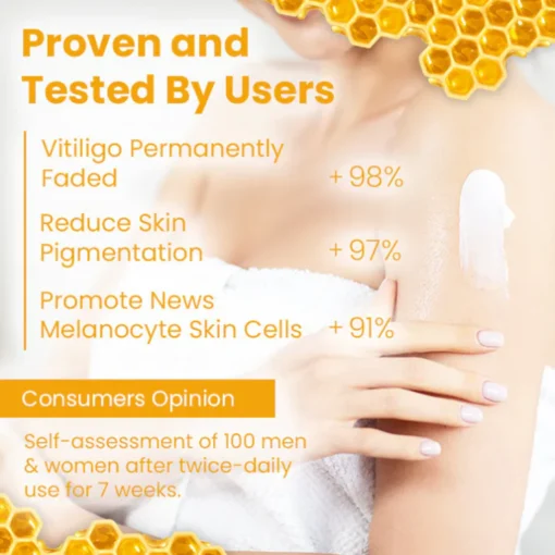 Oveallgo™ Vitiligo Rescue Bee Venom Care Cream - Image 5