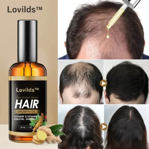 Lovilds™ Rapid Hair Growth Serum - Image 6