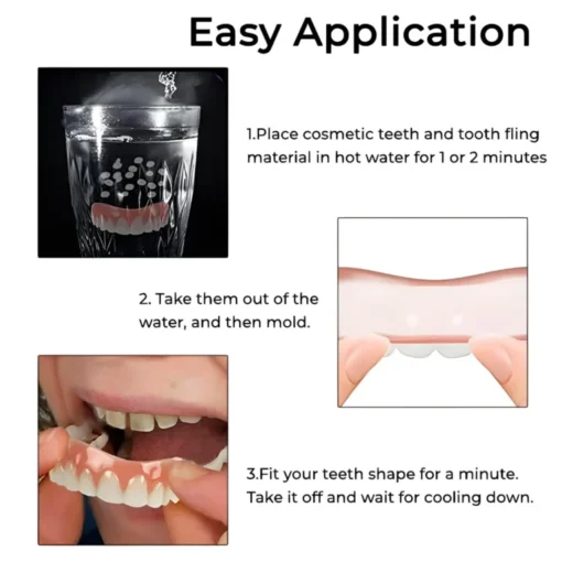 Dentiseal™ Soft Denture Reline Kit - Image 5