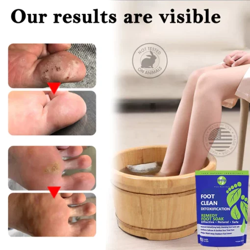 Fivfivgo™ Herbal Detoxifying Cleansing Foot Care Pack - Image 6