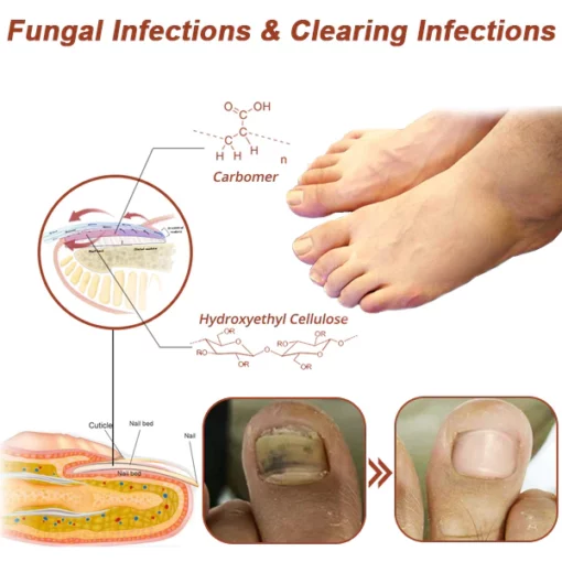 Fivfivgo™ Revolutionary High-Efficiency Light Therapy Device For Toenail Diseases - Image 7