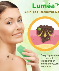 Luméa™ Skin Tag Remover Soap