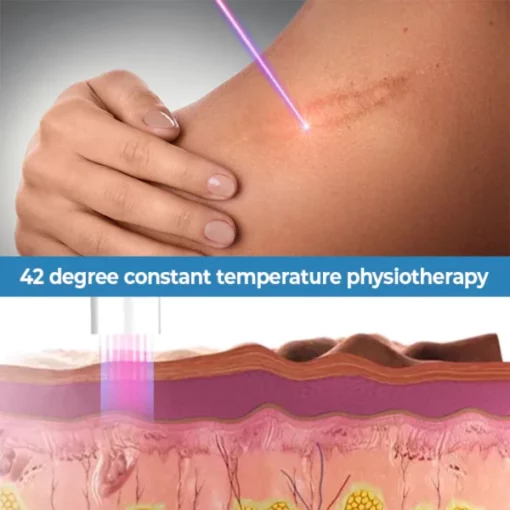 ScarFade™ UV Phototherapy Scar Removal Pen - Image 4