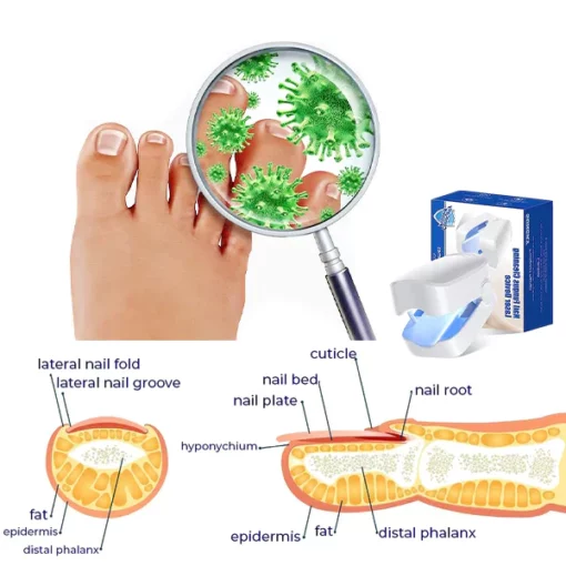 Fivfivgo™ Revolutionary High-Efficiency Light Therapy Device For Toenail Diseases - Image 5