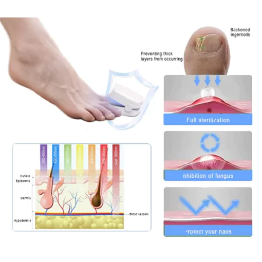 Fivfivgo™ Revolutionary High-Efficiency Light Therapy Device For Toenail Diseases - Image 3