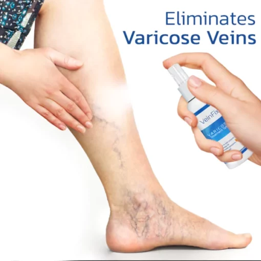 VeinFix Varicose Healing Spray - Image 3