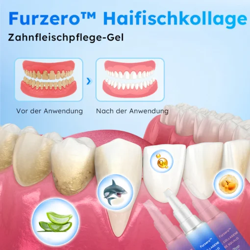 Furzero™ Haifischkollagen Zahnfleischpflege-Gel - Image 3