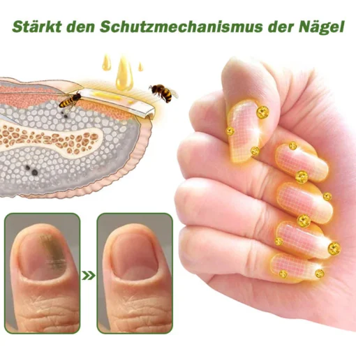 Furzero™ Nagelverteidigung Bienengift-Behandlungsserum - Image 6