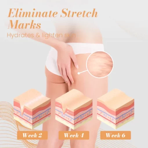 Ceoerty™ BootyLift Collagen Patch - Image 3