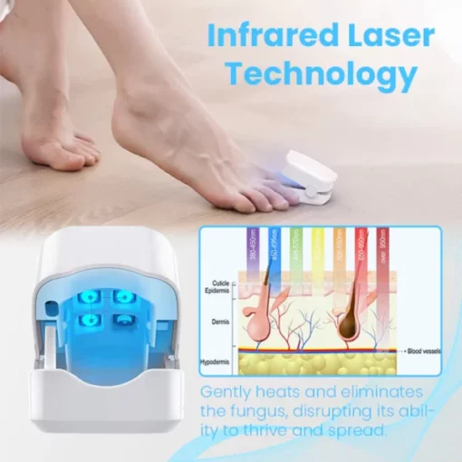 Ceoerty™ FungiGuard Nail Laser Therapy Device - Image 7