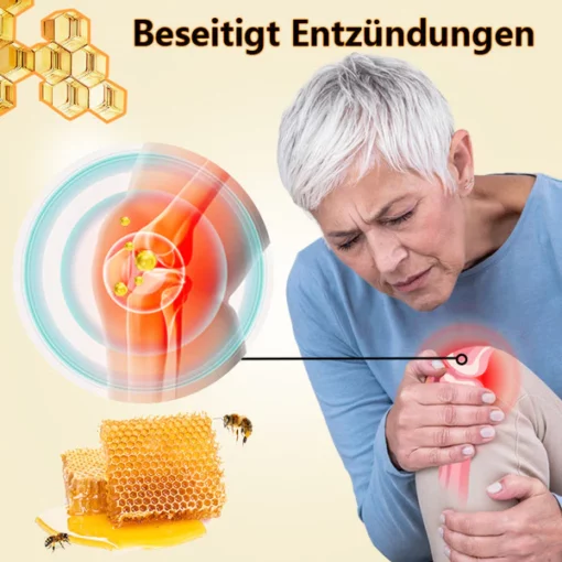 Ourlyard ™ Neuseeländisches Bienengift Professionelles Pflegegel - Image 3