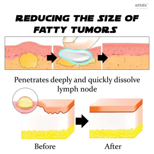 ATTDX LymphNode SculptingDrainage DetoxCream - Image 6