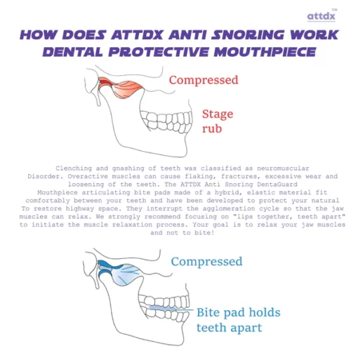 ATTDX AntiSnoring DentaGuard Mouthpiece - Image 7