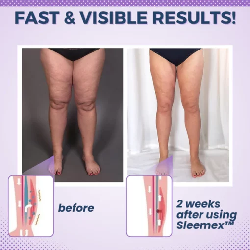 Sleemex™ Overnight Slimming Compression Socks - Image 6