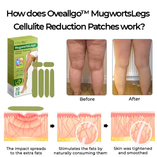 Oveallgo™ MugwortsLegs FIRM Cellulite Reduction Patches - Image 4