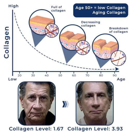 flysmus™ Collagen Refill Pro Face Créme Homme - Image 3