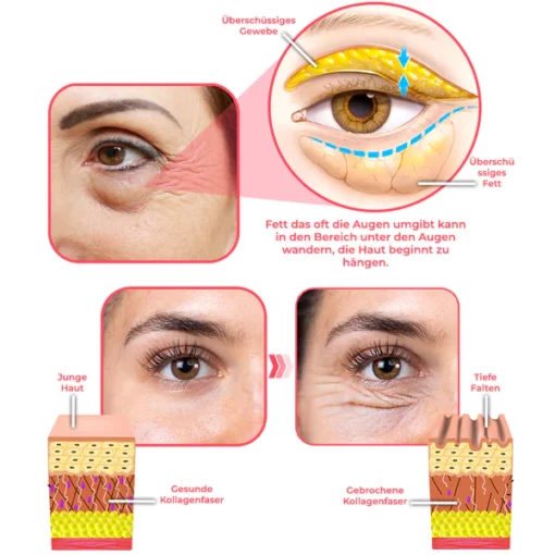 flysmus™ StrahlendeAugen Kollagen Straffende Augenbalsam-Stick - Image 6