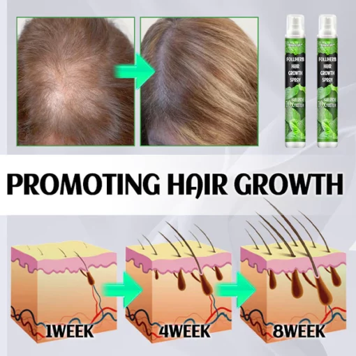 Biancat™ FolliHerb Hair Growth Spray - Image 4