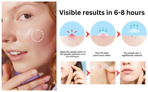 Fivfivgo™ Nighttime Acne Patch - Image 8