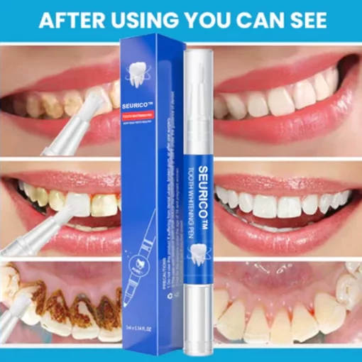 Seurico™ Tooth Whitening Pen - M o o n q o . c o m