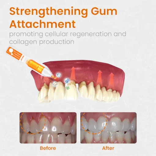 Furzero™Gum Repair Treatment Ampoules - Image 6