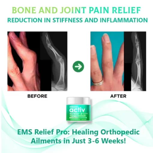 Ourlyard™ Super EMU Joint and Bone Therapy Cream - Image 4