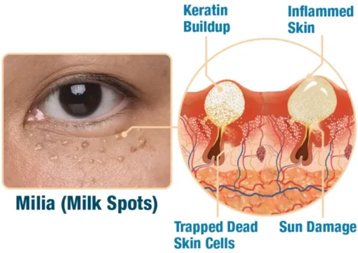 flysmus™ CaviarLuxe Far Infrared Radiance Milk Spot Cream - Image 7