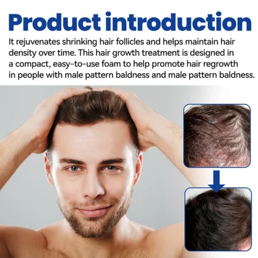 Renewhair X Hair Growth Foam - Image 3