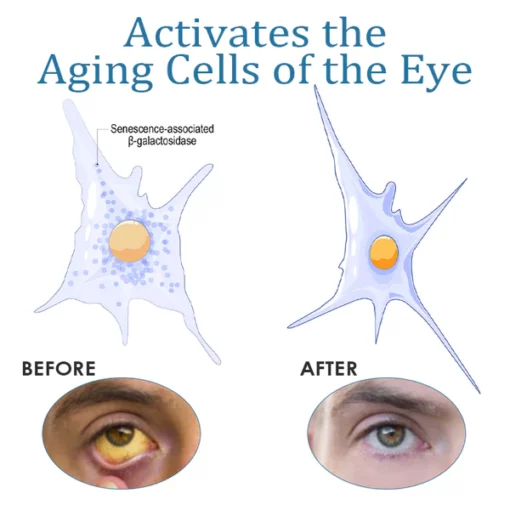 ATTDX Eye Problem Treatment Reversal Eye Drops - Image 3